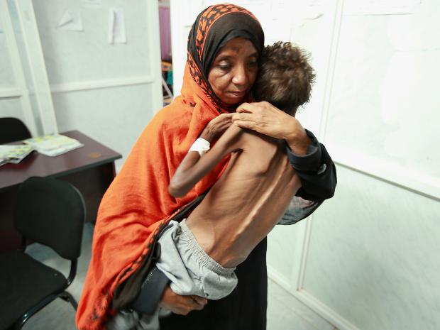 hodeidah-yemen starvation